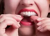 aligners-300x221.webp