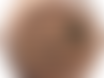 Stinging Nette Salve Benefits