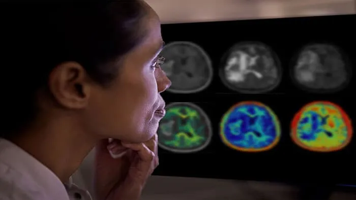 A person attentively examines colorful brain scans on a screen in a dimly lit room, conveying focus and analysis.
