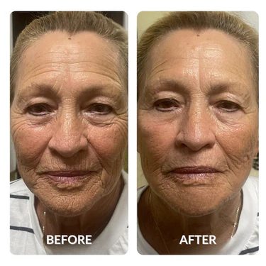 Aging_before_and_after_photo_by_spacetouch_375x_crop_center.webp