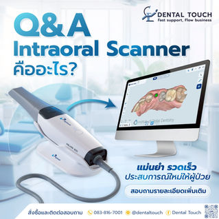 Q&A: Intraoral Scanner คืออะไร?