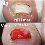 nitidraad voorbeeld .jpeg