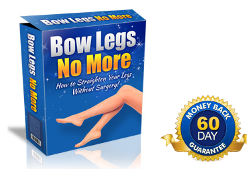 Bow legs No More