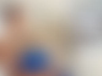 Man having a CoolSculpting treatment