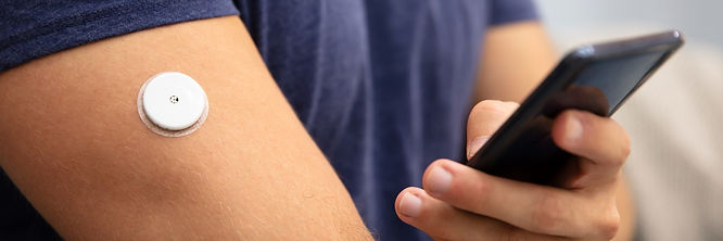 diabetes-Technology-CGM-flash-glucose-mo