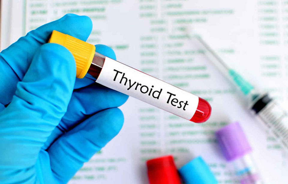 thyroid.jpeg