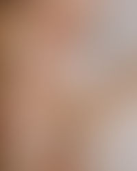 Pro-aging: natuurlijke huidverjonging begint bij ontspanning