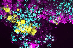 SDS-Bone-Marrow-on-a-Chip.jpeg