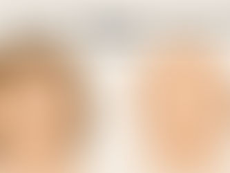 Fetal Alcohol Spectrum Disorder (FASD): The Invisible Disability