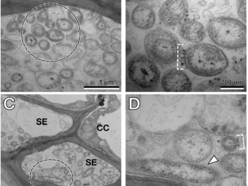 Rethinking Bacterial Disease Management: From Pathogen Biology to Phage Precision