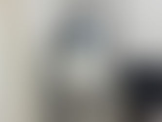 Onda Lifting Korea: Bengkak, Nyeri, Efek, dan Berapa Lama Hasilnya Bertahan