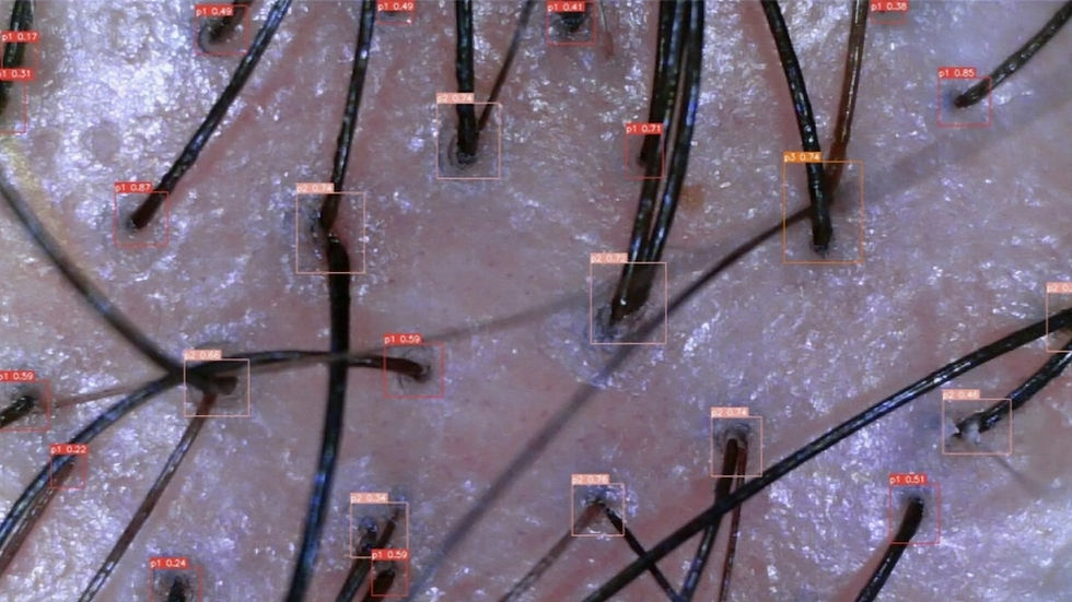 Close-up of human scalp with black hair strands. Red boxes highlight hair roots with numerical labels, showcasing detection analysis.