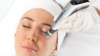 Microneedling zur Faltenbehandlung - DermapenWorld