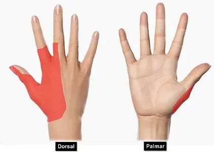 N_-radial-sensitivo-mão-web.webp