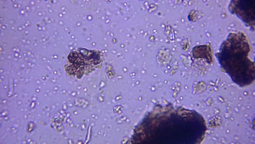 Organic Compost under Microscope