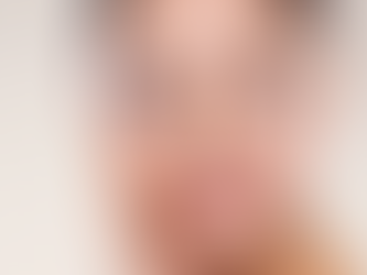 What does Radiance Peeerbium peel treat?