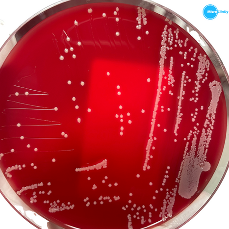 LOS "FAMOSOS" Staphylococcus aureus BORSA Y SU IMPACTO SOBRE EL TRATAMIENTO CON CEFAZOLINA.