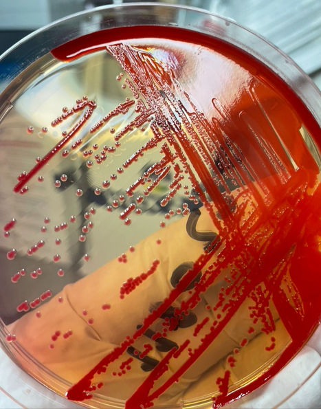 Brotes de infecciones en unidades neonatales: El papel de Serratia marcescens