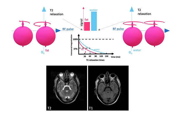 Image contrast: T2 decay (difference of fat and water)