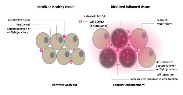 Mode of action: extracellular contrast agents in MRI