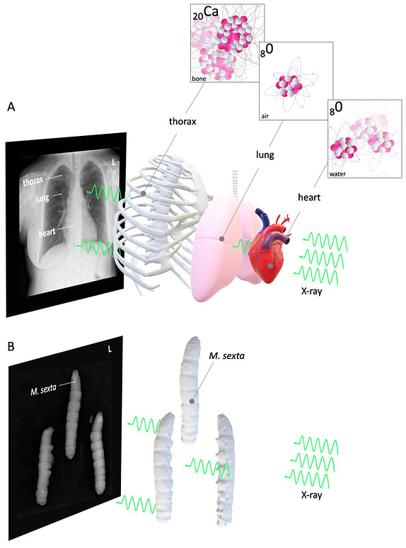 Basic concept of radiography