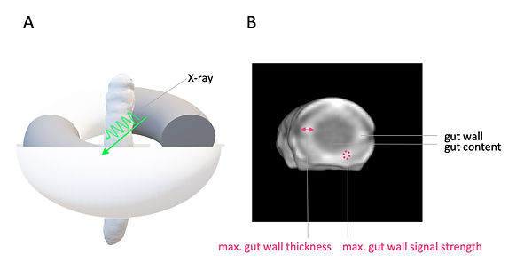 M. sexta in CT imaging and imaging findings for phenotyping of colitis-like lesions