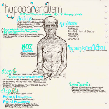 hypoadrenalism.jpeg