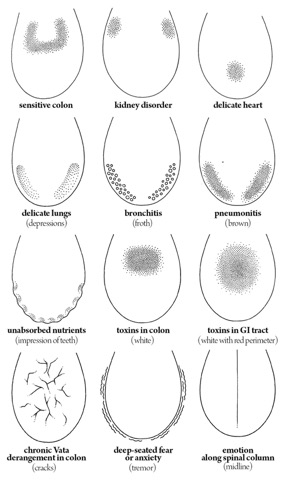 Tongue Diagnosis