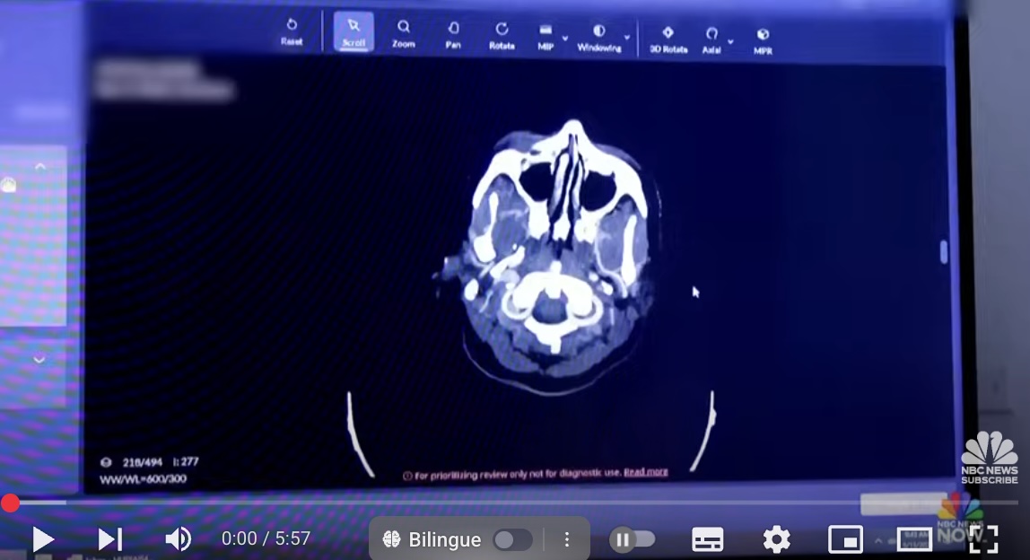 Doctors seek help from AI in medical diagnosis