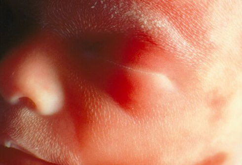 baby at second timester 24 weeks pregnancy