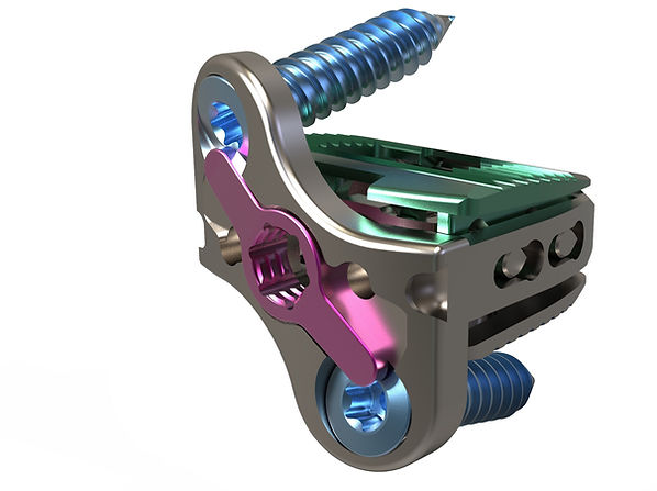 HiJAK Stand Alone Expandable Cervical Interbody