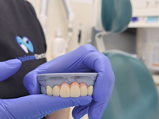 Smile Makeover on the Sunshine Coast: What to Expect, What's Involved, and How to Choose the Right Dentist
