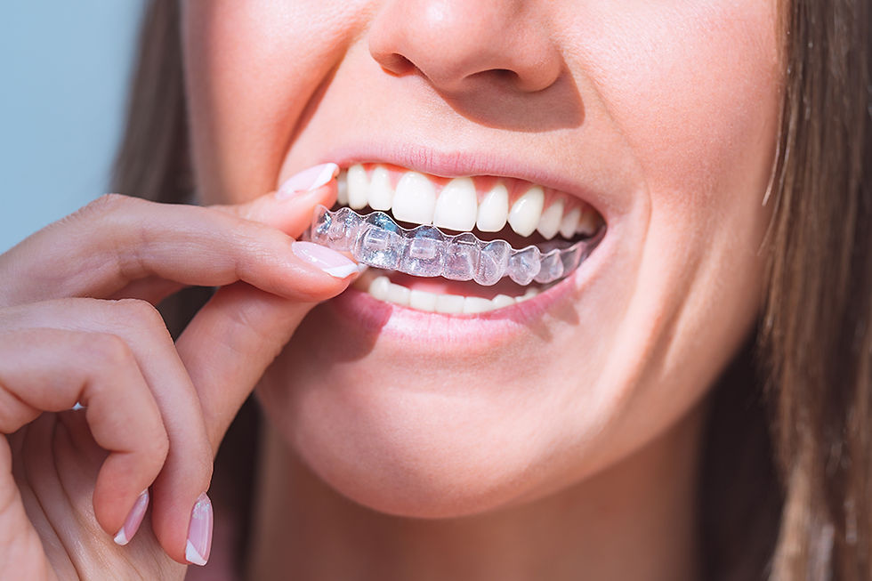 Invisalign and Spark on the Sunshine Coast