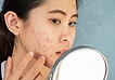 Homeopathic treatment for acne, eczema, psoriasis, and chronic skin conditions