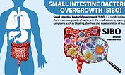 SIBO digestive bloating relief with natural homeopathic treatment