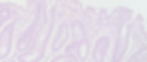 Intestino.jpg