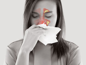 Sinus Infections (Sinusitis): Causes, Symptoms, and When to Seek Care