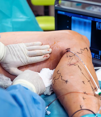 The-Right-Vascular-Surgeon.jpg
