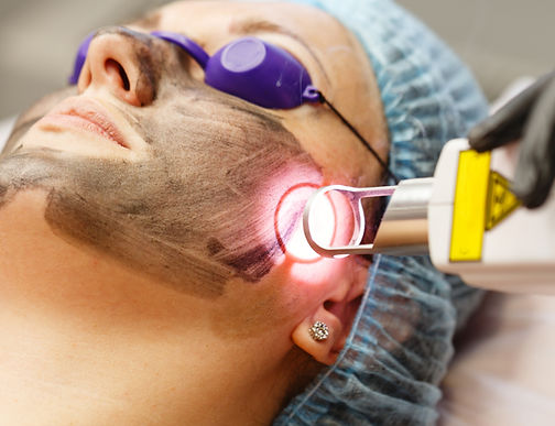 Best Carbon Laser Peel Mumbai & Ahmedabad at SkinMD