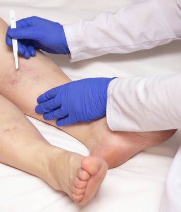 Vascular Surgery.jpg
