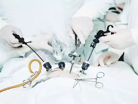 Laparoscopy in Ruptured Ectopic Pregnancy