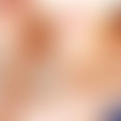 Problemas de aprendizado