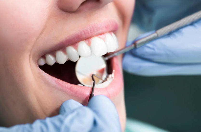 Polizza sanitaria docenti e ATA, copertura anche per dentista e implantologia: 100 euro per la prevenzione e fino a 2.400 euro per gli impianti