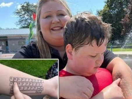 Mamma si tatua una tastiera sul braccio per comunicare con il figlio con autismo non verbale: «Pur di dargli voce, mille cicatrici»