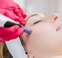 Boost Collagen and Radiance with Microneeding