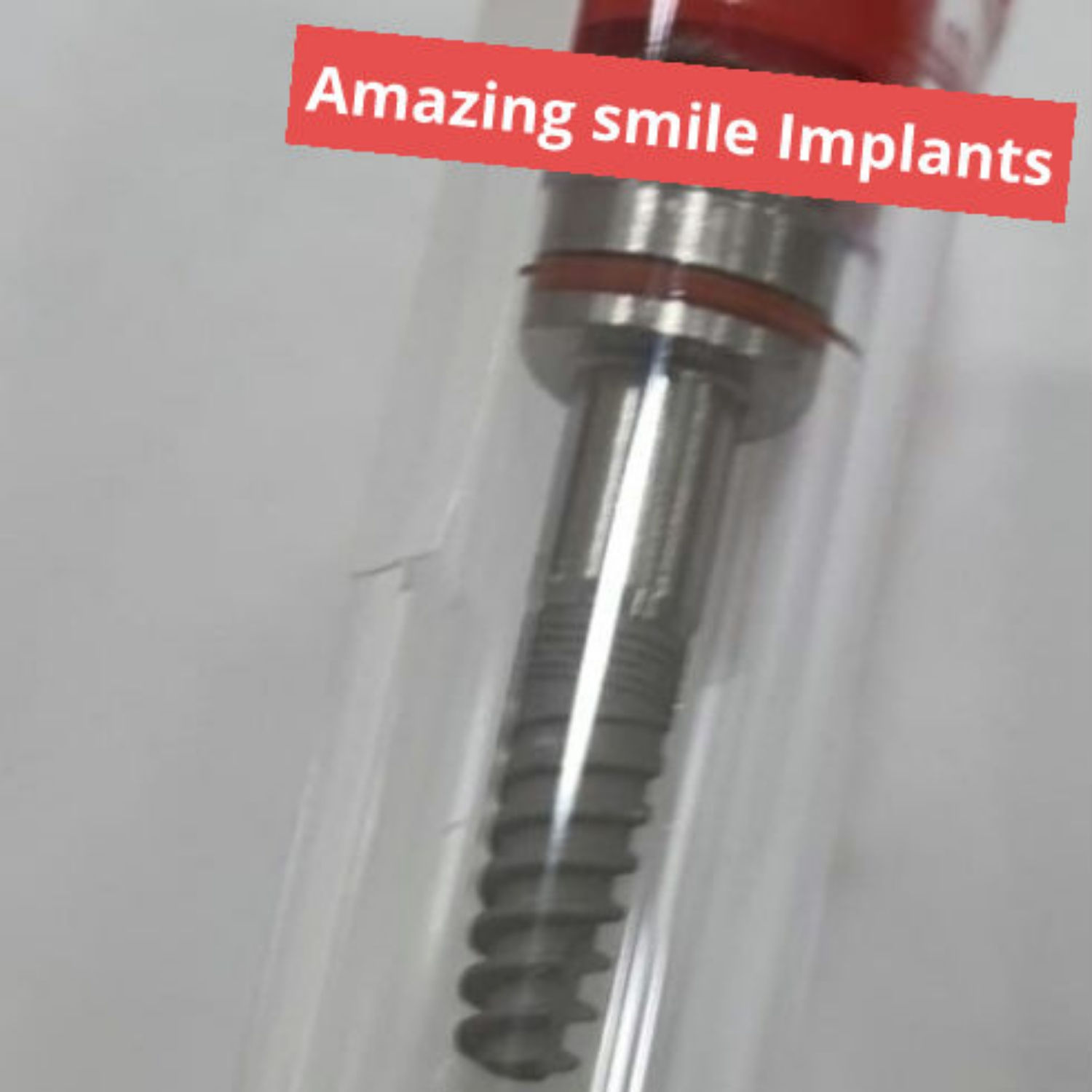 Spiral Dental Implant