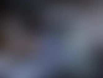 Ολόσωμη Λιπομέτρηση: Ανάλυση σύστασης σώματος με ιατρική ακρίβεια