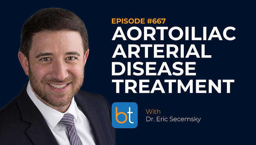 Aortoiliac Arterial Disease Treatment