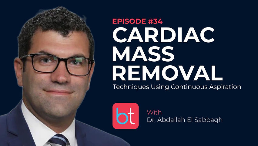 Understanding Cardiac Mass Removal: Techniques Using Continuous Aspiration