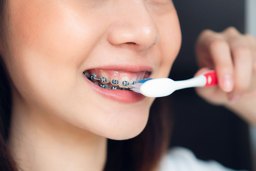 Bellevue Park Dental in Bellevue, WA 98008 Family Cosmetic Veneers Implants Invisalign Emergency - Crowns, Wisdom Teeth Extraction, IV Sedation, Kor Teeth Whitening, Tooth Bonding, Porcelain Veneers, Bridges, Fillings, Dentures, Children's Dentistry, Tooth Extractions, Exams, Cleanings, Root Canal Therapy, Dental check Up, Botox & Dermal Fillers, Inlay & Onlays